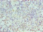 hnRNP D Antibody in Immunohistochemistry (Paraffin) (IHC (P))