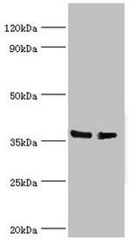 hnRNP D Antibody in Western Blot (WB)