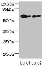 CHRNA6 Antibody in Western Blot (WB)