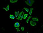 CCDC6 Antibody in Immunocytochemistry (ICC/IF)