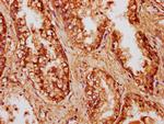 CCDC6 Antibody in Immunohistochemistry (Paraffin) (IHC (P))