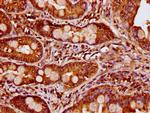 CCDC6 Antibody in Immunohistochemistry (Paraffin) (IHC (P))