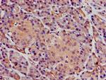 SGMS1 Antibody in Immunohistochemistry (Paraffin) (IHC (P))