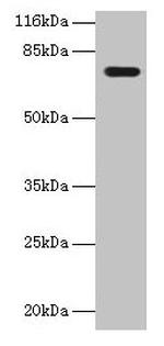 KBTBD2 Antibody in Western Blot (WB)