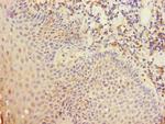 CD35 Antibody in Immunohistochemistry (Paraffin) (IHC (P))