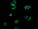 Nectin 4 Antibody in Immunocytochemistry (ICC/IF)