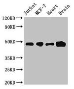 ZNF645 Antibody in Western Blot (WB)