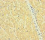 SLC38A9 Antibody in Immunohistochemistry (Paraffin) (IHC (P))