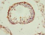 QKI Antibody in Immunohistochemistry (Paraffin) (IHC (P))