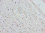 CTNNBL1 Antibody in Immunohistochemistry (Paraffin) (IHC (P))