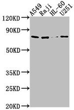 RANBP9 Antibody in Western Blot (WB)