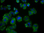 SLC19A3 Antibody in Immunocytochemistry (ICC/IF)