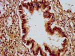 ALG9 Antibody in Immunohistochemistry (Paraffin) (IHC (P))