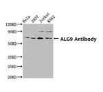 ALG9 Antibody in Western Blot (WB)