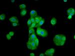 MOV10L1 Antibody in Immunocytochemistry (ICC/IF)