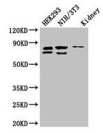 NUP85 Antibody in Western Blot (WB)