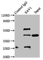 SAV1 Antibody in Western Blot (WB)