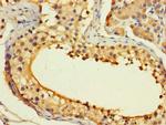 ASF1B Antibody in Immunohistochemistry (Paraffin) (IHC (P))