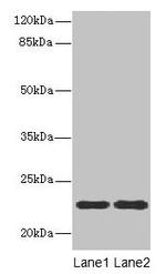 ASF1B Antibody in Western Blot (WB)