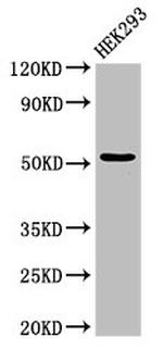 CYP39A1 Antibody in Western Blot (WB)