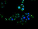 VPS25 Antibody in Immunocytochemistry (ICC/IF)