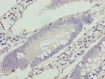 VPS25 Antibody in Immunohistochemistry (Paraffin) (IHC (P))