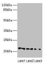 VPS25 Antibody in Western Blot (WB)