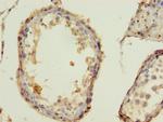 BarX1 Antibody in Immunohistochemistry (Paraffin) (IHC (P))