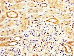 WASF3 Antibody in Immunohistochemistry (Paraffin) (IHC (P))