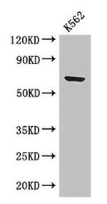 BTRC Antibody in Western Blot (WB)