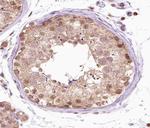 FGFR1OP Antibody in Immunohistochemistry (Paraffin) (IHC (P))