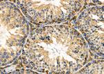 HSPE1 Antibody in Immunohistochemistry (Paraffin) (IHC (P))