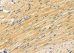 HSPE1 Antibody in Immunohistochemistry (Paraffin) (IHC (P))