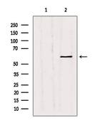 MMP11 Antibody in Western Blot (WB)