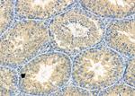 GAK Antibody in Immunohistochemistry (Paraffin) (IHC (P))