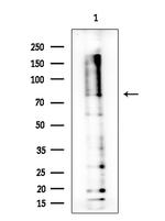 ZIC1/ZIC2/ZIC3 Antibody in Western Blot (WB)