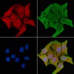 ADPGK Antibody in Immunocytochemistry (ICC/IF)