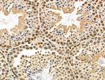 Phospho-CtBP1 (Ser422) Antibody in Immunohistochemistry (Paraffin) (IHC (P))