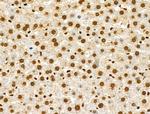 Phospho-CtBP1 (Ser422) Antibody in Immunohistochemistry (Paraffin) (IHC (P))