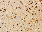 Phospho-CtBP1 (Ser422) Antibody in Immunohistochemistry (Paraffin) (IHC (P))