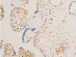 Phospho-SYK (Tyr323) Antibody in Immunohistochemistry (Paraffin) (IHC (P))