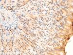 Phospho-SYK (Tyr323) Antibody in Immunohistochemistry (Paraffin) (IHC (P))