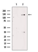 Phospho-ABL1/ABL2 (Tyr393) Antibody in Western Blot (WB)
