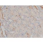 Phospho-BCL-2 (Ser70) Antibody in Immunohistochemistry (Paraffin) (IHC (P))