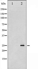 Phospho-p21 (Thr145) Antibody in Western Blot (WB)