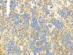 Phospho-SMAD2/SMAD3 (Thr8) Antibody in Immunohistochemistry (Paraffin) (IHC (P))