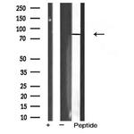 FSHR Antibody in Western Blot (WB)