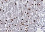 KEAP1 Antibody in Immunohistochemistry (Paraffin) (IHC (P))