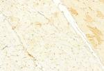 KEAP1 Antibody in Immunohistochemistry (Paraffin) (IHC (P))