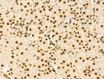 PIASy Antibody in Immunohistochemistry (Paraffin) (IHC (P))